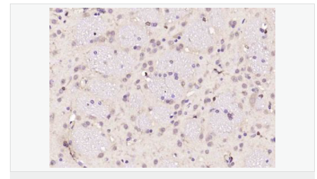 60594850a2cee.png image.png