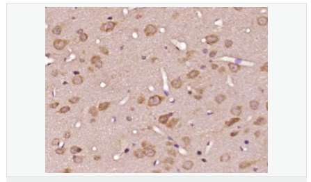 606147de7f90f.png image.png