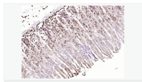 6066ba2f4134b.png image.png