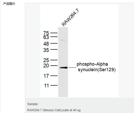 606bcfada376f.png image.png